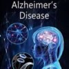 Brain Robber And New Treatments For Alzheimer�S Disease